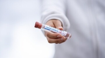 Ученые выяснили, у кого выше вирусная нагрузка при COVID-19