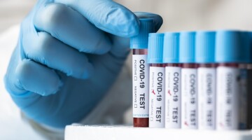 В России и мире растет заболеваемость COVID-19
